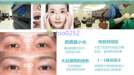QQ截图20170411152853.png