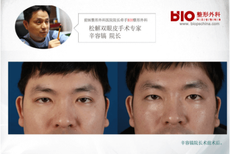 QQ截图20170411152926.png