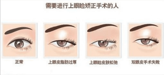 QQ截图20170419103027.png