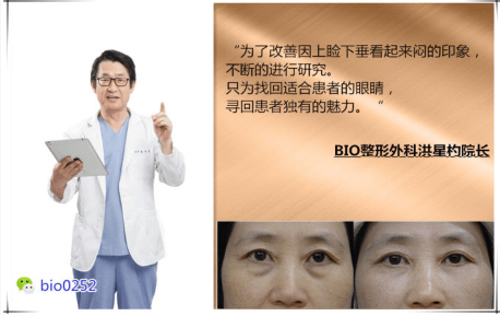 QQ截图20170420141712.png