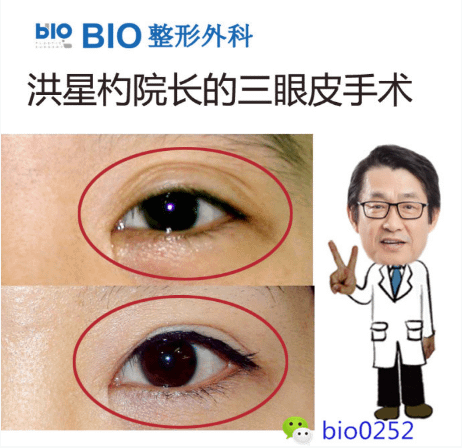QQ截图20170420141723.png