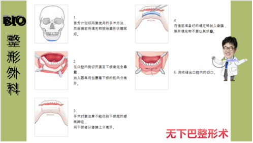 QQ截图20170427141001.png