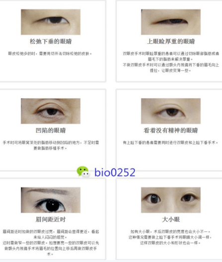 QQ截图20170518161335.png