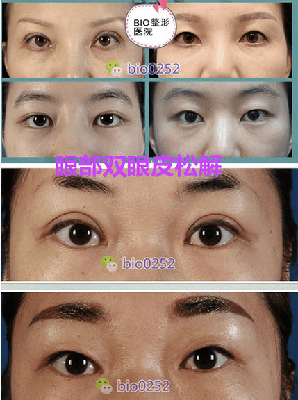 QQ截图20170523163038.png