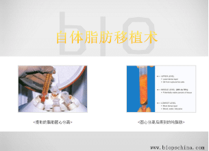 QQ截图20170613140317.png