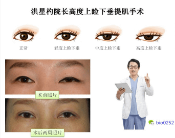 QQ截图20170613140651.png