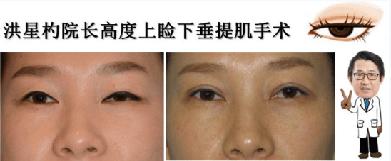 QQ截图20170616150326.png
