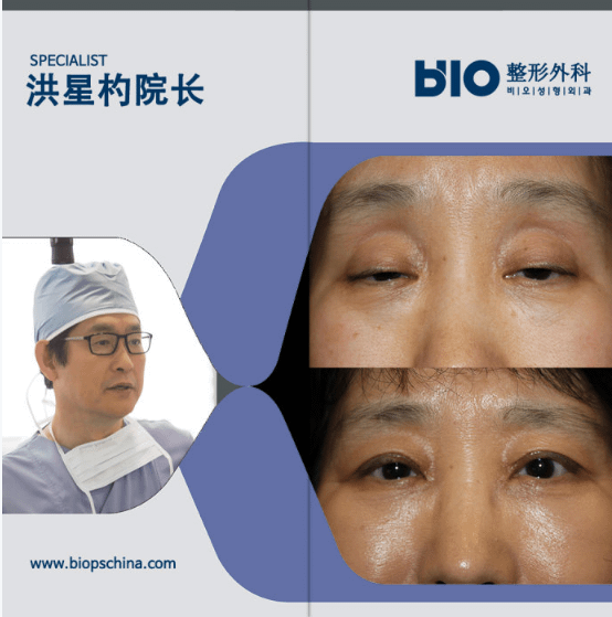 QQ截图20170616150355.png