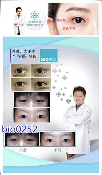 QQ截图20170426174528 - 복사본.png