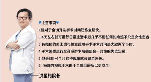 QQ截图20170621142726.png
