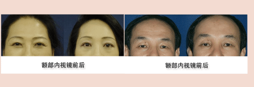 QQ截图20170621142716.png