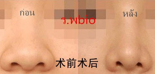 20140503042044660.jpg