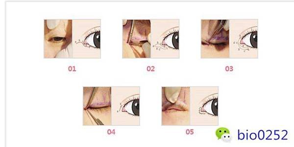 006CdbnPzy7cJxSSmd856%26;690.jpg