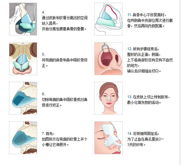 QQ截图20170720101414.png