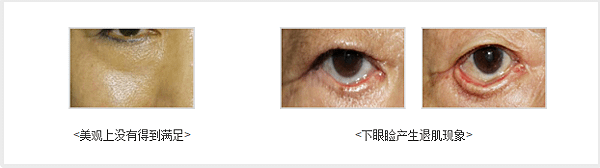 QQ截图20170721113030.png