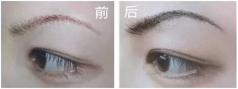 006HPGbOzy7cZqjZ8rX2d%26;690.png