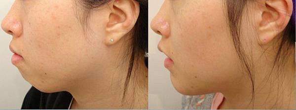 006p9jd5zy7dOP06sSt11%26;690.jpg