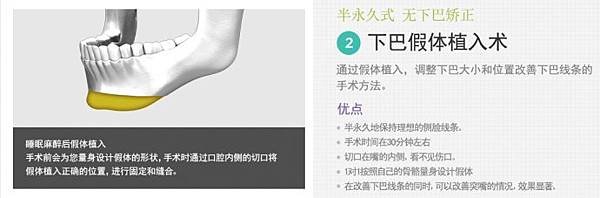 006p9jd5zy7gFCc3kZH69%26;690.jpg