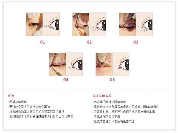 006p9jLGzy7ii2SqwkH53%26;690.jpg