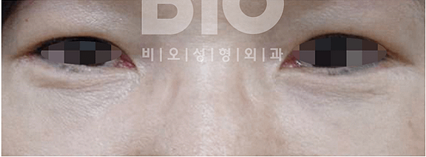 after_53101127b8931.png