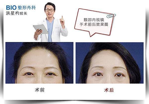 006CdbnPzy7jf52xesNe9%26;690.jpg