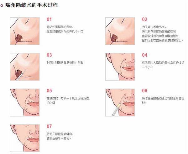 微信截图_20180406103738.jpg