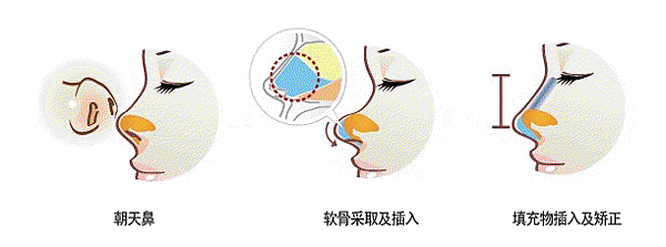 短鼻2.gif