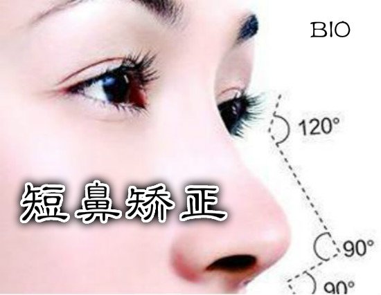 短鼻0.jpg
