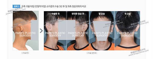 007aQj5Vzy7m64BPeTO74%26;690.jpg