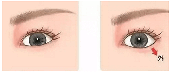 007eFQ9Bzy7ncJ84AHb45%26;690.png