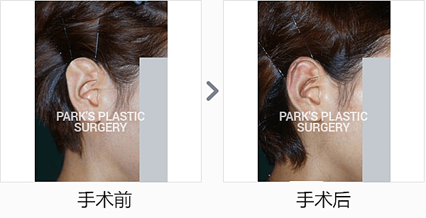 斯塔尔斯_副本.png