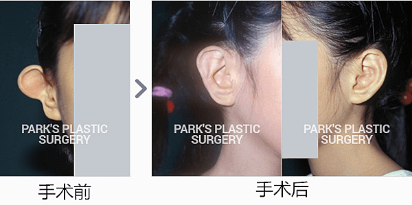 问号耳_副本.png
