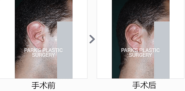 贝壳耳_副本.png