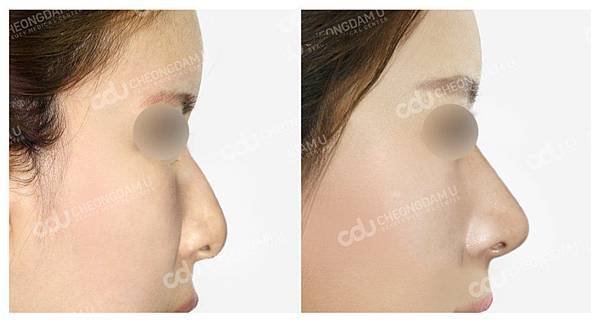 005y9hrmzy7pKyHKbBj35%26;690.jpg