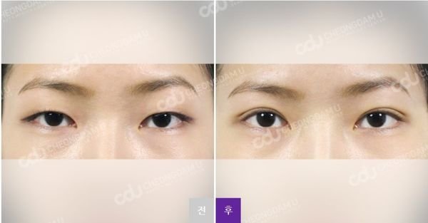 005y9hrmzy7pMc6K2JW18%26;690.jpg