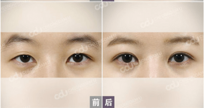 005y9hrmzy7qgqo5jVP65%26;690.png