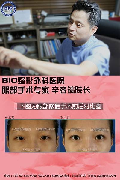 2.12眼睛3.jpg