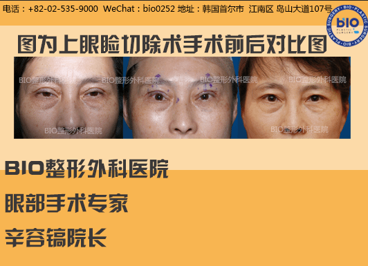 2.12眼睛4.png