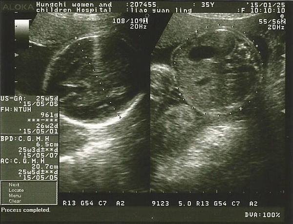 26w-b2