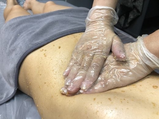 腹部去角質