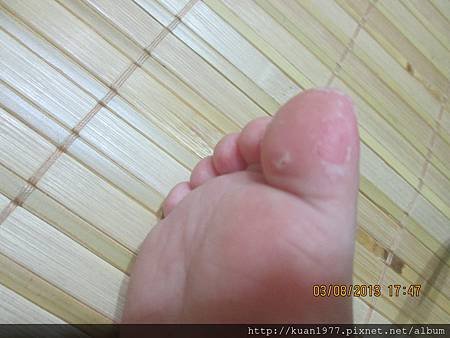 照片 181
