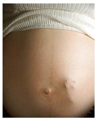 healthy_pregnancy_image