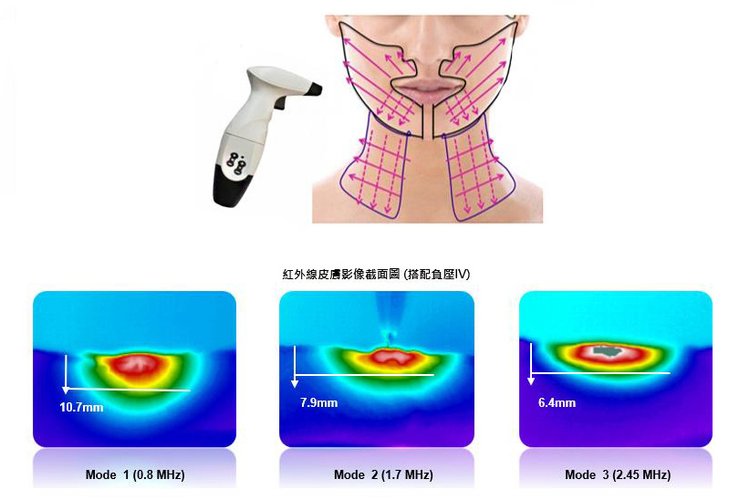 緊塑V顏電波馬甲電波瘦身減肥06.jpg