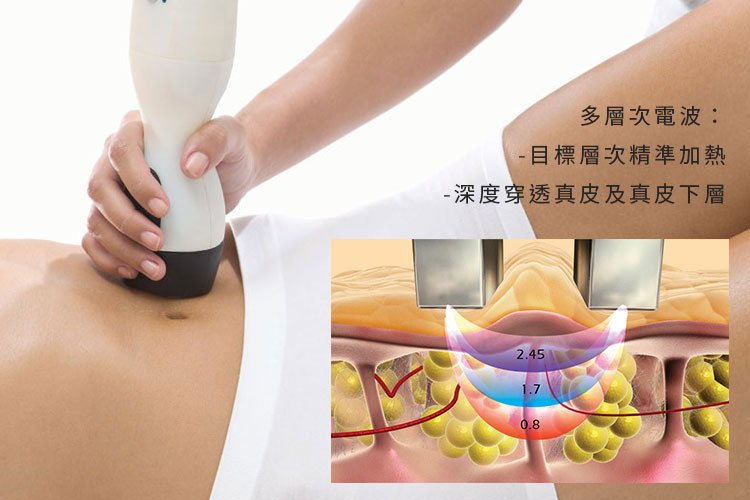 Reaction4D馬甲電波美肌博士蘋果型身材瘦身減肥緊緻線條減脂 (3).jpg