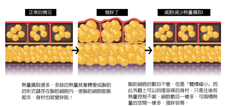 sculpsure絲酷秀體雕雷射溶脂非侵入式冷凍溶脂雷射減脂冷凍減脂7.png