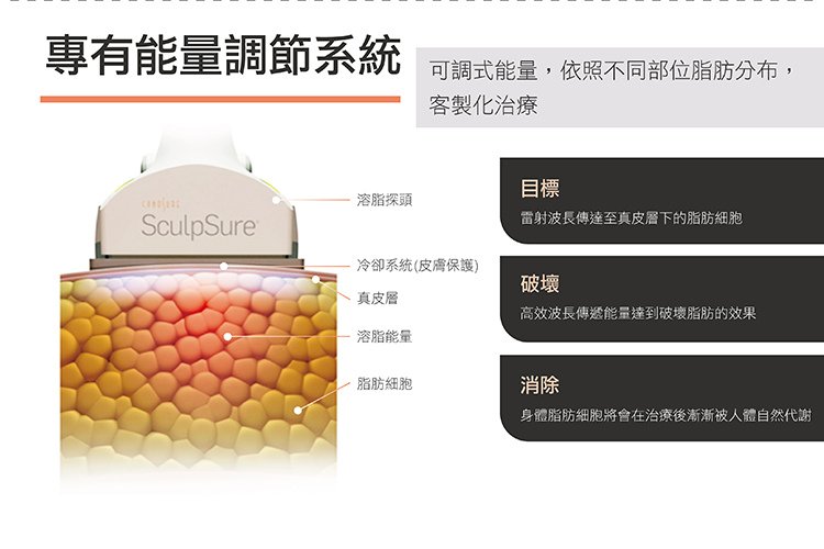 sculpsureSculpSure絲酷秀體雕減肥抽脂溶脂減重腹部大腿小腹肥胖手臂