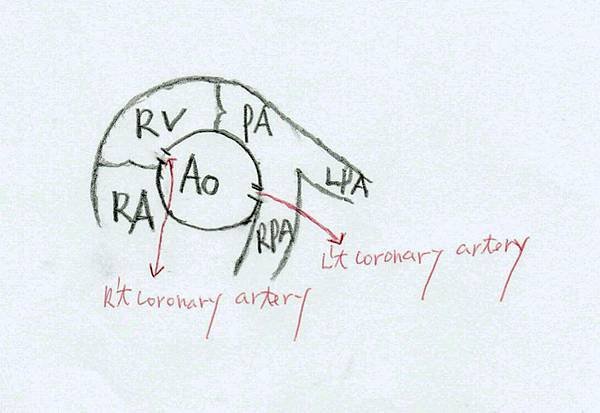 54-short axis