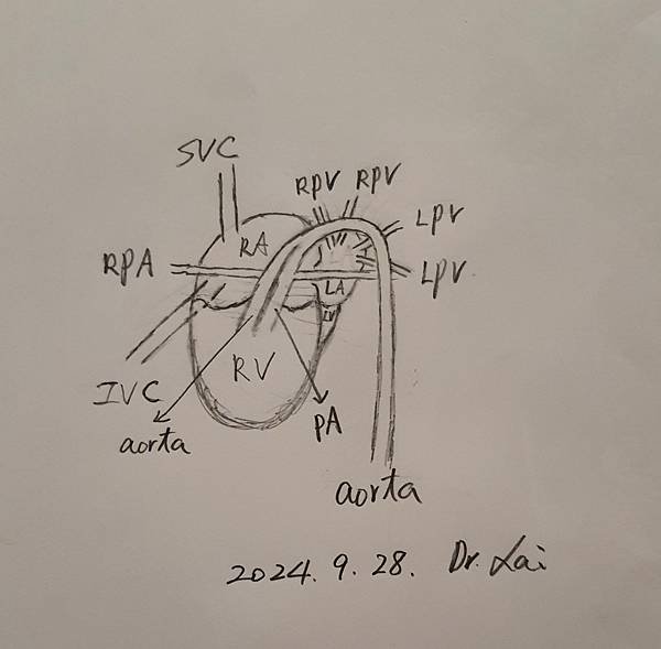 孕兒診所賴錫鉅醫師 439 產前診斷單一心室案例分享 : 有