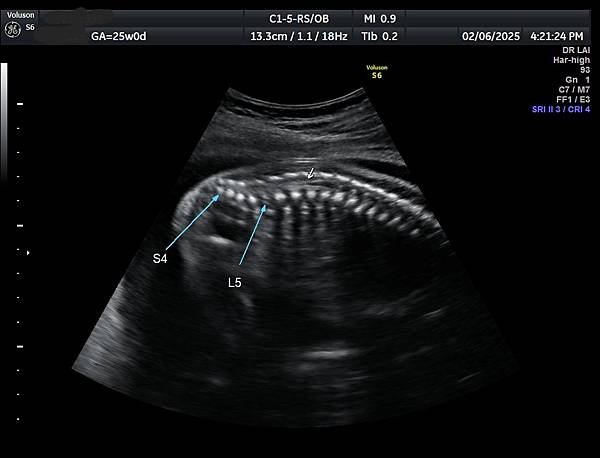 孕兒診所賴錫鉅醫師 455 執行高層次超音波檢查可以很輕鬆也