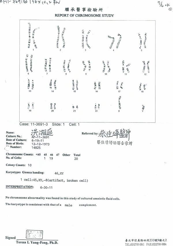羊膜穿刺檢查報告